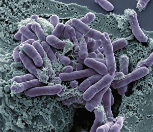 Escherichia Coli SEM Drucke: Bacterial contamination, SEM