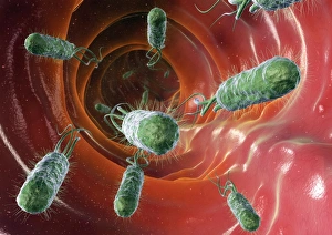 E Coli Bacteria Drucke: Bacterial diarrhoea, artwork