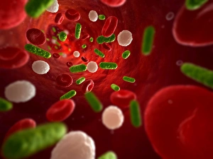Science Illustrations Online Drucke: Bacterial infection, artwork