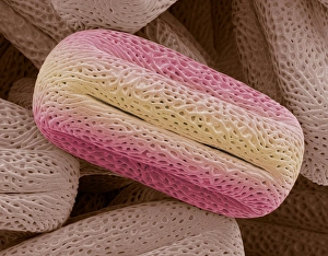 Pollen Grain Morphology Drucke: Bay tree pollen, SEM