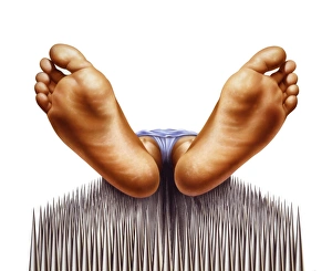 Alternative Healing Methods Drucke: Bed of nails, artwork