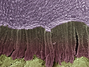 Epithelial Cell Structure Drucke: Bile duct, SEM