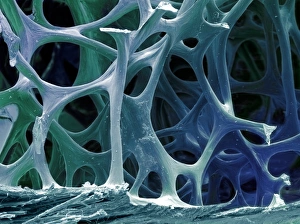 Drucke von Vogelknochengewebe. Farbige Rastertonenmikroskopaufnahme (SEM) von kancellösem (Körner-) Knochentissue eines Rohins Bilder Datiert 2009 Juni: Vogelknochengewebe, SEM
