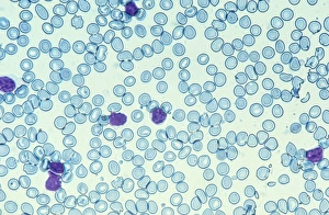 White Blood Cell Function Drucke: Blood cells, light micrograph