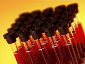 Medical Research Drucke: Blood samples C018 / 1034