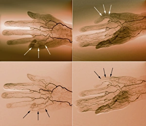 Blutversorgung der Hand, Angiogramme C018/0389