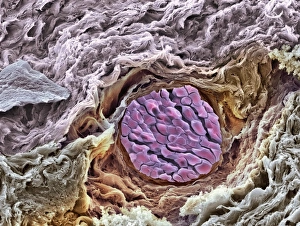 Scanning Electron Microscope Photos Drucke: Blood vessel, SEM