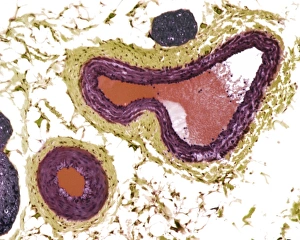 Blood Vessel Anatomy Drucke: Blood vessels, light micrograph
