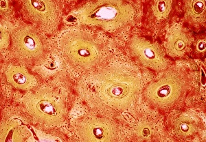 Human Bone Anatomy Drucke: Bone canals, light micrograph