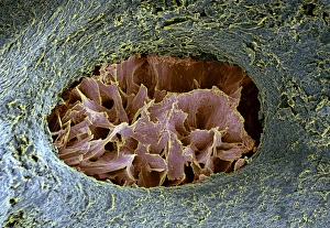 Coloured SEM Images Drucke: Bone lacuna, SEM