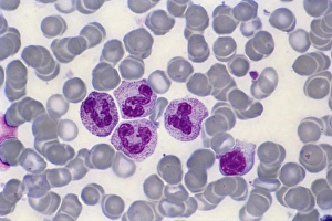 Light Micrograph Images Drucke: Bone marrow blood cells, light micrograph