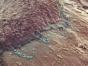 Coloured SEM Images Drucke: Bone reabsorption, SEM