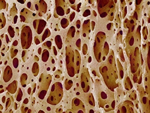 Drucke von Knochengewebe. Farbener Scanning Electron Mikroskopbild (SEM) von Kancellarischen (Pulverknochengegewebe). Die Knochengewebekan bezeichnen sich entweder als cortexal oder kavernös Bilder Datiert 2004 September: Knochengewebe