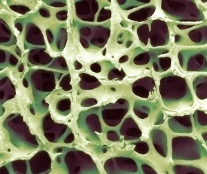Bilder vom 7. März 2013: Knochengewebe, SEM