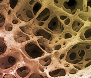 Cancellous Bone Structure Drucke: Bone tissue, SEM C013 / 4766