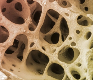 Bilder Datiert 15. Juni 2012: Knochengewebe, SEM C013/4767
