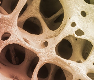 Cancellous Bone Structure Drucke: Bone tissue, SEM C013 / 4768