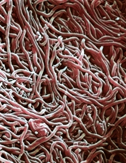 Coloured SEM Micrograph Drucke: Borrelia bacteria, SEM