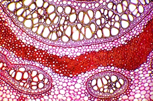Light Micrograph Drucke: Bracken rhizome, light micrograph