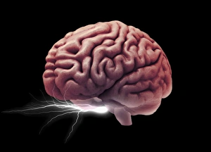 Magnetic Resonance Imaging (MRI) Drucke: Brain activity, composite image C018 / 0652