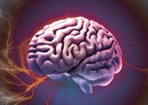 Magnetic Resonance Imaging (MRI) Drucke: Brain activity, composite image C018 / 0658