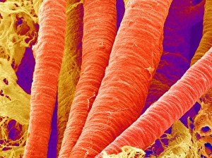 Blood Circulation System Drucke: Brain arteries, SEM