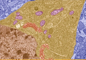 Transmission Electron Microscopy Images Drucke: Brain cell, TEM C013 / 4799