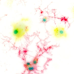 Brain Cell Structure Drucke: Brain cells, light micrograph