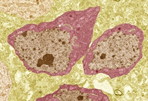Transmission Electron Microscopy Images Drucke: Brain cells, TEM C013 / 4800