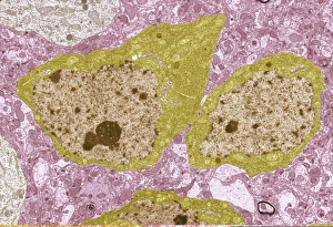 Transmission Electron Microscopy Images Drucke: Brain cells, TEM C013 / 4801