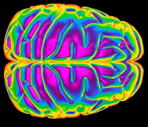 Drucke von Der Gehirn. Computerartwerk eines menschlichen Gehirns (Oberansicht). Die Vorderseite des Gehirns ist rechts. Das Gehirn ist das Nervenzentrum, das körperliche Funktionen und Gedanken kontrolliert Bilder Datiert 2001 Oktober: Brain