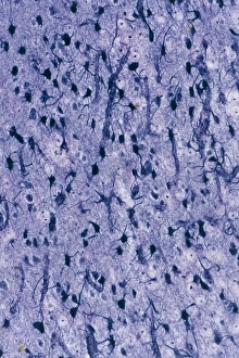 Central Nervous System Cells Drucke: Brain glial cells, light micrograph C016 / 0523