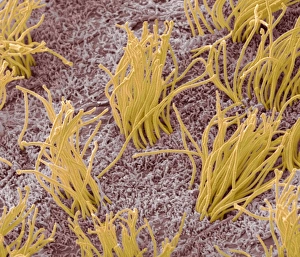 Drucke von Der Gehirnhautlinien. Farbiger Rasterton SEM (Scanning Electron Micrograph) der Linie des Gehirns, die sogenannten Haare mit Zähnen (Orange) von Epithelzellen zeigt Bilder Datiert 2012 März: Zirbenhaut, SEM