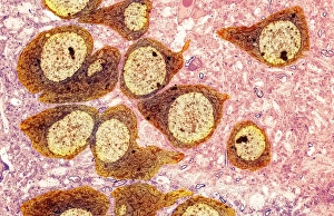Drucke von Zentrales Nervensystemzellen, Transmissionselektronenmikroskopbild von einer Schnitt durch Gehirntissue aus dem Cerebrum mit zahlreichen Neuronen (Nervenzellen) umgeben von Axonen und Dendritiken Bilder Datiert 2012 August: Gehirn Nervenzellen, TEM C014 / 0357