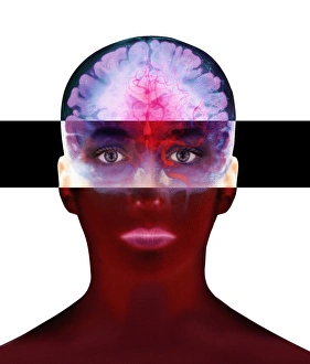Nervous System Diagrams Drucke: Brain scan