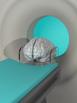 Medical Diagnostic Equipment Drucke: Brain scan, conceptual artwork