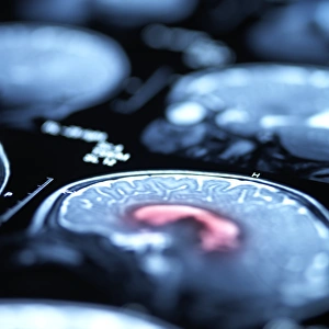 Cerebral Cortex Structure Drucke: Brain scans