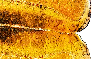 Light Microscopy Images Drucke: Brain tissue, light micrograph