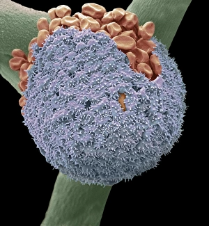 Scanning Electron Microscopy Images Drucke: Bread mould, SEM C016 / 9052
