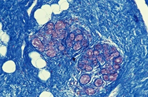 Bilder Datiert 22. April 2013: Brustgewebe, lebendes Mikroskopbild C015/6743