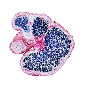 Light Microscopy Images Drucke: Broad bean root nodules, light micrograph