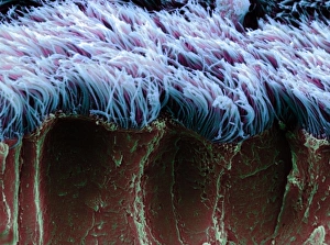 Bilder Datiert 5. August 2003: Bronchiale Zilien, SEM