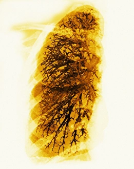 Lung Anatomy Drucke: Bronchioles
