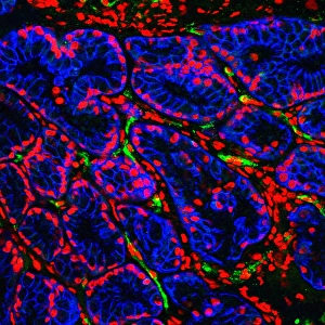 Drucke von Brunners Drüsen. Fluoreszenz mikroskopische Aufnahme einer Schnittstelle durch den menschlichen Duoden (Darm) mit Brunners Drüsen (blau) Bilder Datiert 2006 Juni: Brunners Drüsen im Duodenum