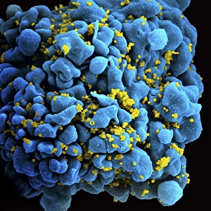 Human Immunodeficiency Virus Drucke: Budding HIV particles, SEM C017 / 8302