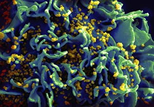 Human Immunodeficiency Virus Drucke: Budding HIV particles, SEM C018 / 8599