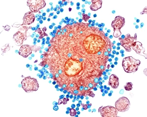Human Immunodeficiency Virus Drucke: Budding HIV particles, TEM C018 / 0123