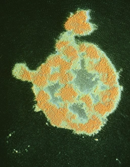 Staphylococcus Aureus Drucke: Bursting of Staphylo- coccus bacterium