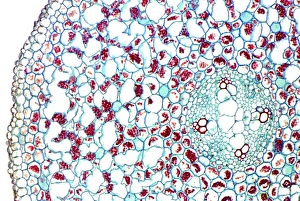 Vascular Bundle Structure Drucke: Buttercup stem, light micrograph