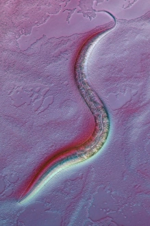 Bilder Datiert 15. April 2011: Nematoda-Wurm, Lichtmikroskopbild